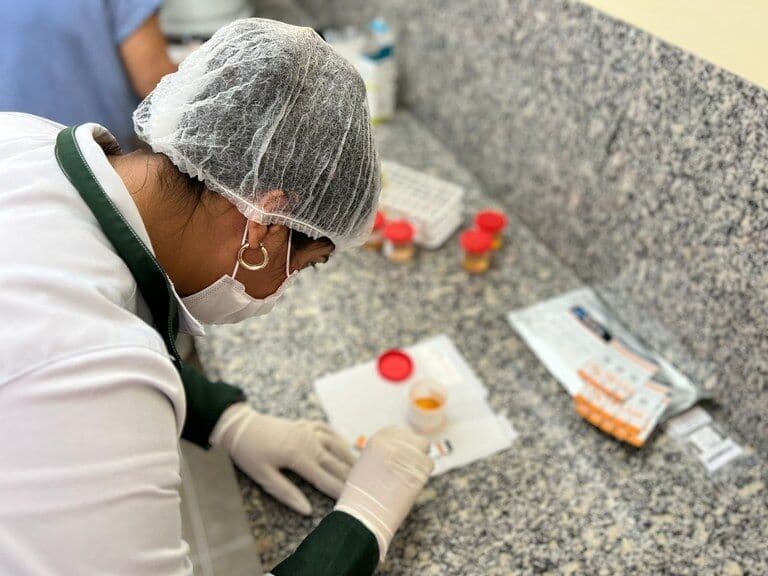 Clementino Fraga faz testes para detecção de tuberculose em 25 minutos e agiliza tratamento de pacientes com HIV/Aids
