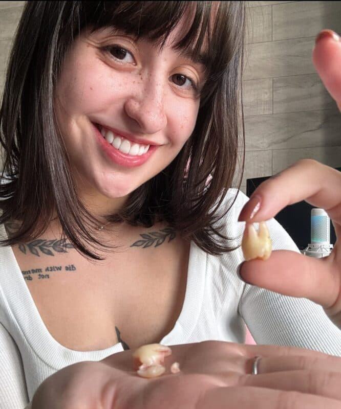 Influenciadora anuncia venda de dentes sisos por R$ 40 mil; prática é considerada crime