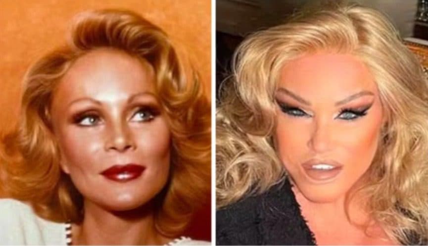 Jocelyn Wildenstein, a 'Mulher-Gato', choca internautas ao mostrar rosto antes de virar recordista em plásticas
