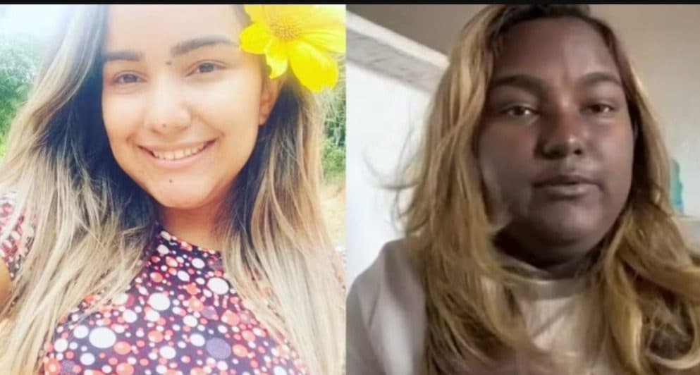 Tumor raro faz jovem cearense sofrer mudança na cor de pele