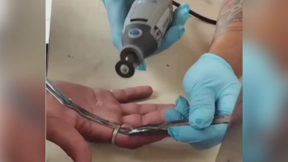 Anel fica preso no dedo de homem em Cabedelo e bombeiros fazem remoção