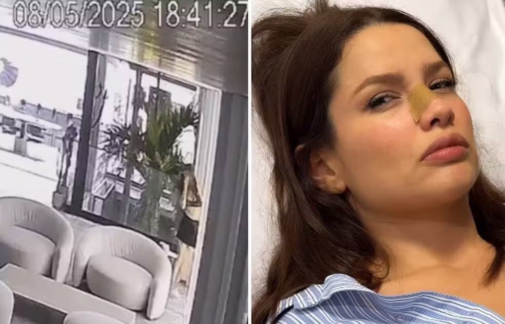 VÍDEO: Juliette bate o rosto em porta de vidro e fratura o nariz