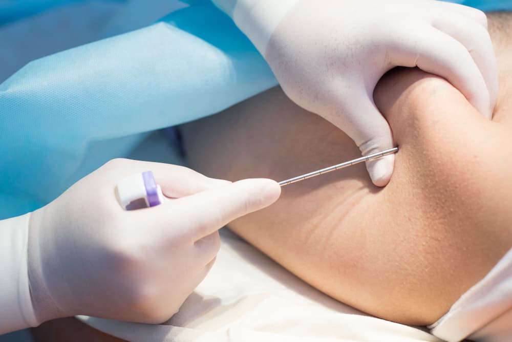 Ministério Público quer devolução de taxa de inscrição a doadores de medula em concurso da Prefeitura de João Pessoa