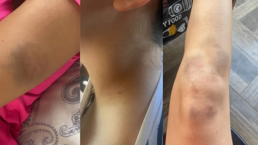 Influenciador Thiago Schutz é preso em flagrante por agredir namorada