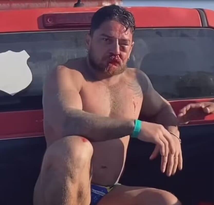 Casal de turistas de Mato Grosso é agredido em Porto de Galinhas