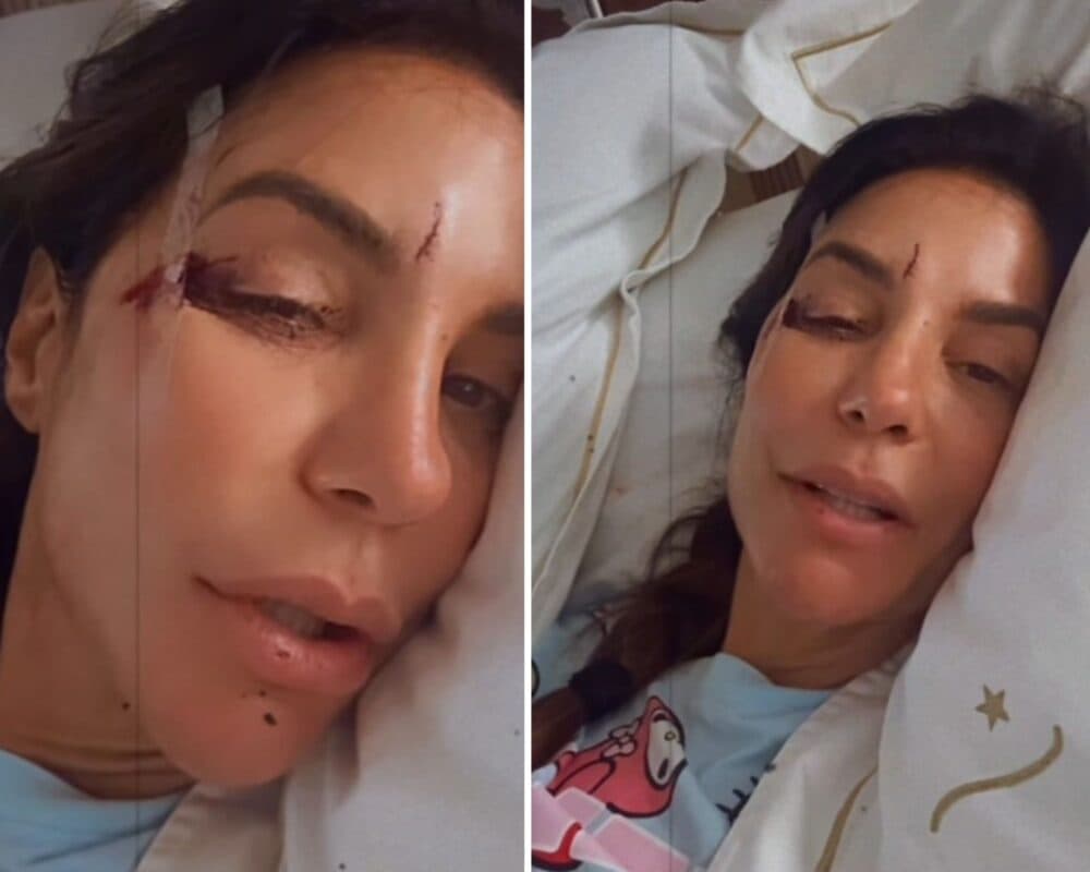 Susto pós-Carnaval: Ivete Sangalo é internada após queda em casa