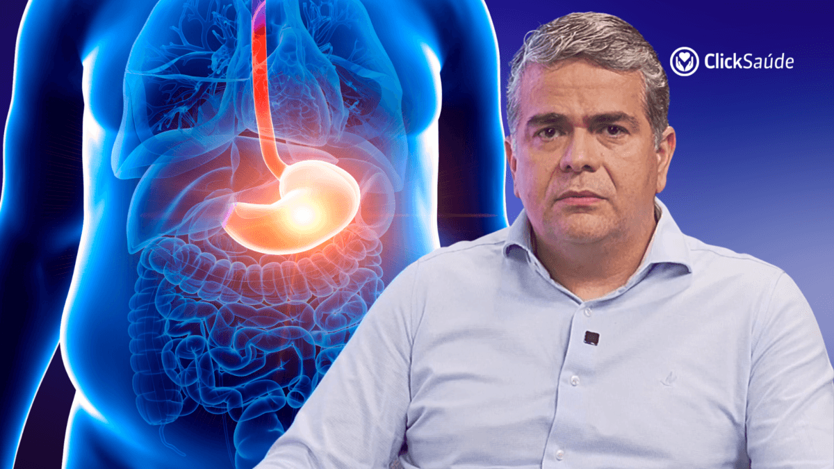 Acalásia: doença rara que causa dificuldade para engolir e pode levar anos para diagnóstico