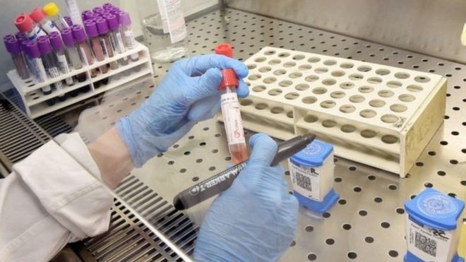 Paraíba descarta mais um caso suspeito de Coronavírus e casos investigados sobem para 48 Paraíba descarta mais um caso suspeito de Coronavírus e casos investigados sobem para 48