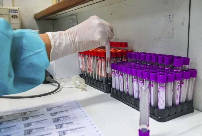 Paraíba confirma 1.004 novos casos de Covid-19 e 13 óbitos pela doença neste domingo Paraíba confirma 1.004 novos casos de Covid-19 e 13 óbitos pela doença neste domingo
