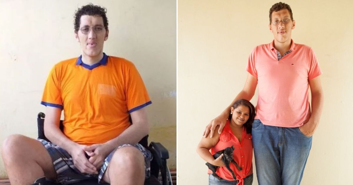 Mais alto do Brasil, Ninão vai precisar amputar perna e família inicia campanha de arrecadação de dinheiro para compra de prótese