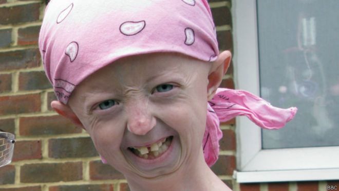 'Adolescente de 100 anos' morre aos 17 na Inglaterra