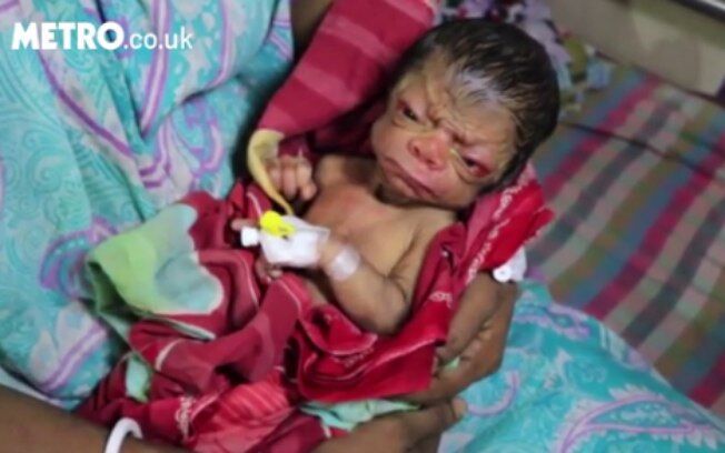 Bebê nasce com aparência de idoso e é comparado a "Benjamin Button" Bebê nasce com aparência de idoso e é comparado a "Benjamin Button"