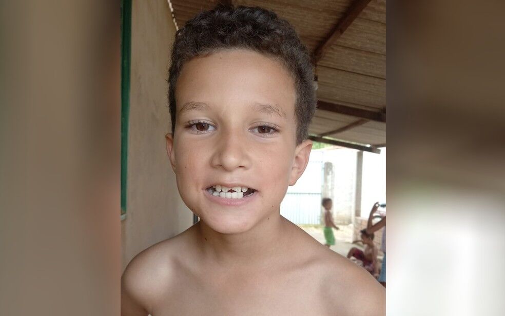 Menino de 9 anos pede tratamento dentário em cartinha para o Papai Noel: ‘Meus dentes estão feios’ Menino de 9 anos pede tratamento dentário em cartinha para o Papai Noel: ‘Meus dentes estão feios’