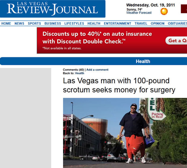 Com saco escrotal de 45 kg, homem precisa de cirurgia de US$ 1 milhão