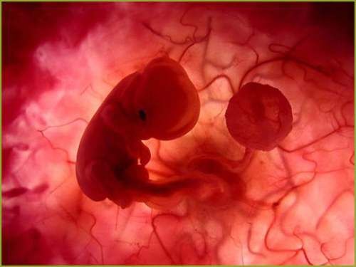 Entenda em quais situações o aborto é permitido no Brasil Entenda em quais situações o aborto é permitido no Brasil