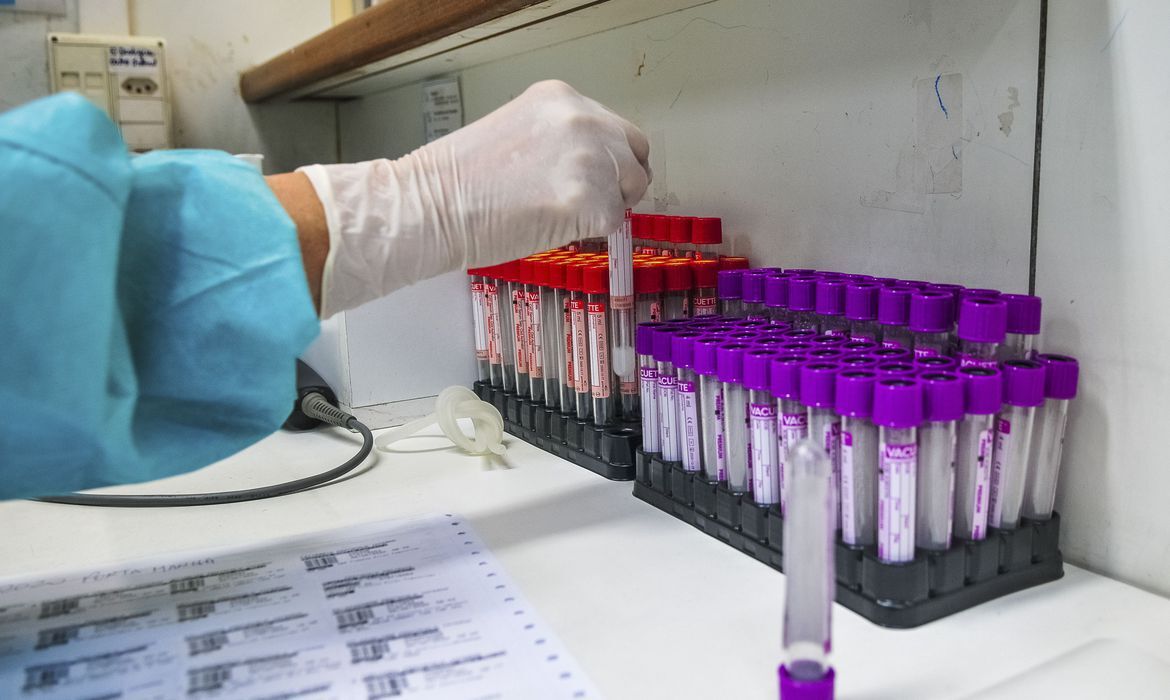 Paraíba confirma 576 casos de Covid-19 e 07 óbitos em 24h; total de mortos chega a 2.977 e 128.032 infectados
