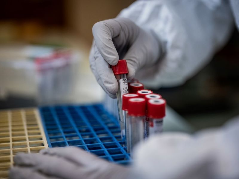 Paraíba confirma 339 novos casos de Covid-19 em 24h; total de mortos chega a 3.138 e 134.297 infectados Paraíba confirma 339 novos casos de Covid-19 em 24h; total de mortos chega a 3.138 e 134.297 infectados