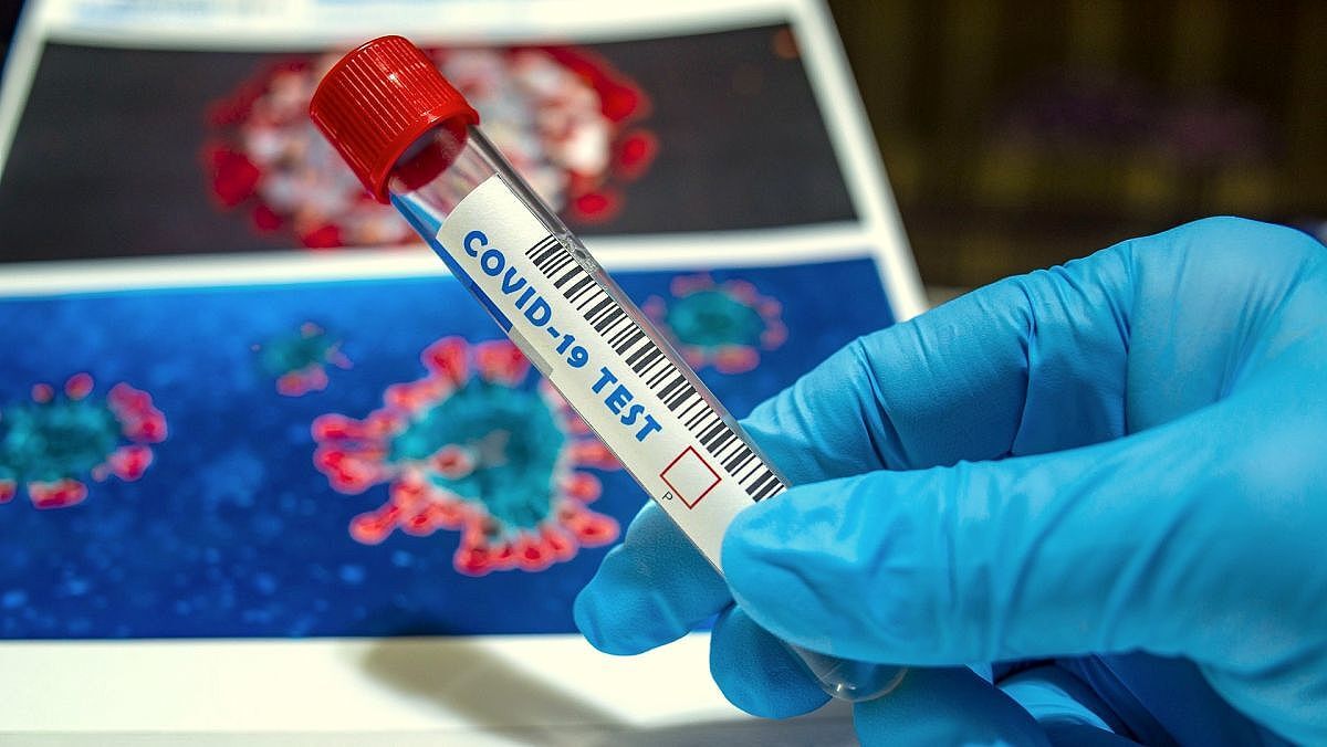 Paraíba confirma 1.549 novos casos de Covid-19 em 24h; total de mortos chega a 1.901 e 85.760 infectados Paraíba confirma 1.549 novos casos de Covid-19 em 24h; total de mortos chega a 1.901 e 85.760 infectados