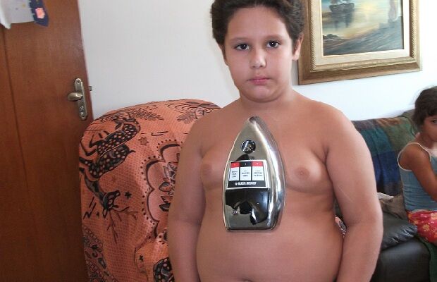 Corpo de menino de 8 anos atrai objetos metálicos Corpo de menino de 8 anos atrai objetos metálicos
