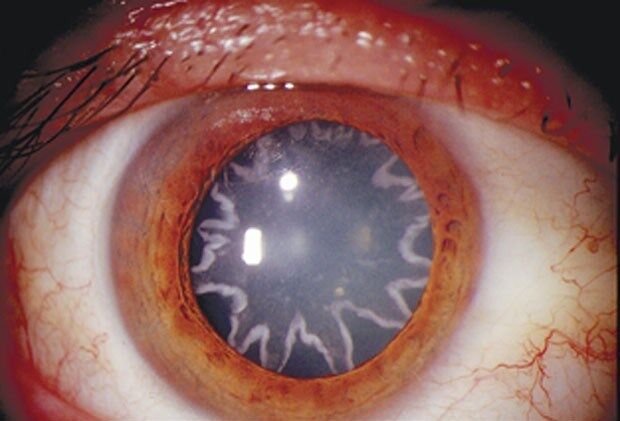 Eletricista leva choque de 14 mil volts e fica com 'estrelas' nos olhos Eletricista leva choque de 14 mil volts e fica com 'estrelas' nos olhos