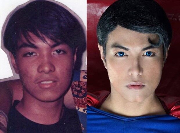 Filipino faz 23 cirurgias e gasta R$20 mil para se transformar no Superman Filipino faz 23 cirurgias e gasta R$20 mil para se transformar no Superman