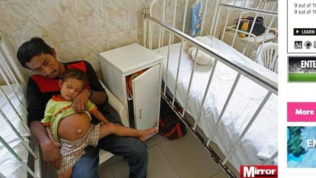 Garoto carrega o feto do irmão em sua barriga Garoto carrega o feto do irmão em sua barriga