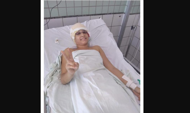Jovem com couro cabeludo arrancado em corrida de kart se recupera de cirurgia Jovem com couro cabeludo arrancado em corrida de kart se recupera de cirurgia