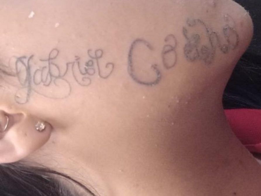 'Me sinto livre', diz jovem ao remover tatuagem feita no rosto pelo ex-namorado 'Me sinto livre', diz jovem ao remover tatuagem feita no rosto pelo ex-namorado