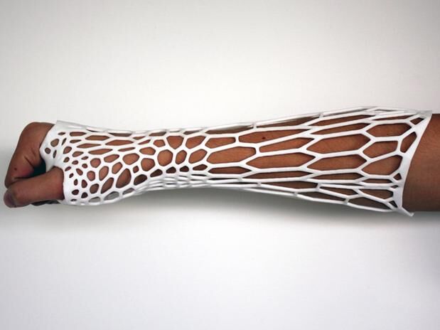 Molde a partir de impressão em 3D pode substituir o gesso Molde a partir de impressão em 3D pode substituir o gesso