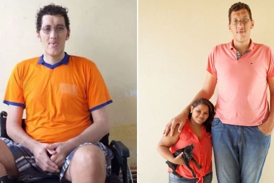 Ninão, homem mais alto do Brasil, consegue cirurgia para amputação da perna e implantação de prótese Ninão, homem mais alto do Brasil, consegue cirurgia para amputação da perna e implantação de prótese