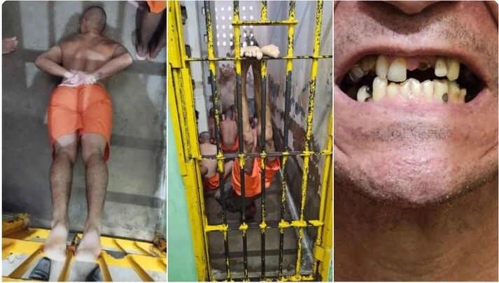 Presos têm dentes arrancados e são pendurados de cabeça para baixo em sessões de tortura no Ceará Presos têm dentes arrancados e são pendurados de cabeça para baixo em sessões de tortura no Ceará