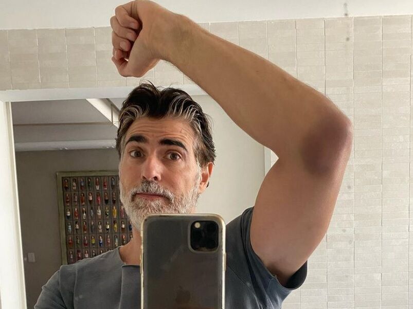 Reynaldo Gianecchini sofre acidente em gravação de 'Bom Dia, Verônica'