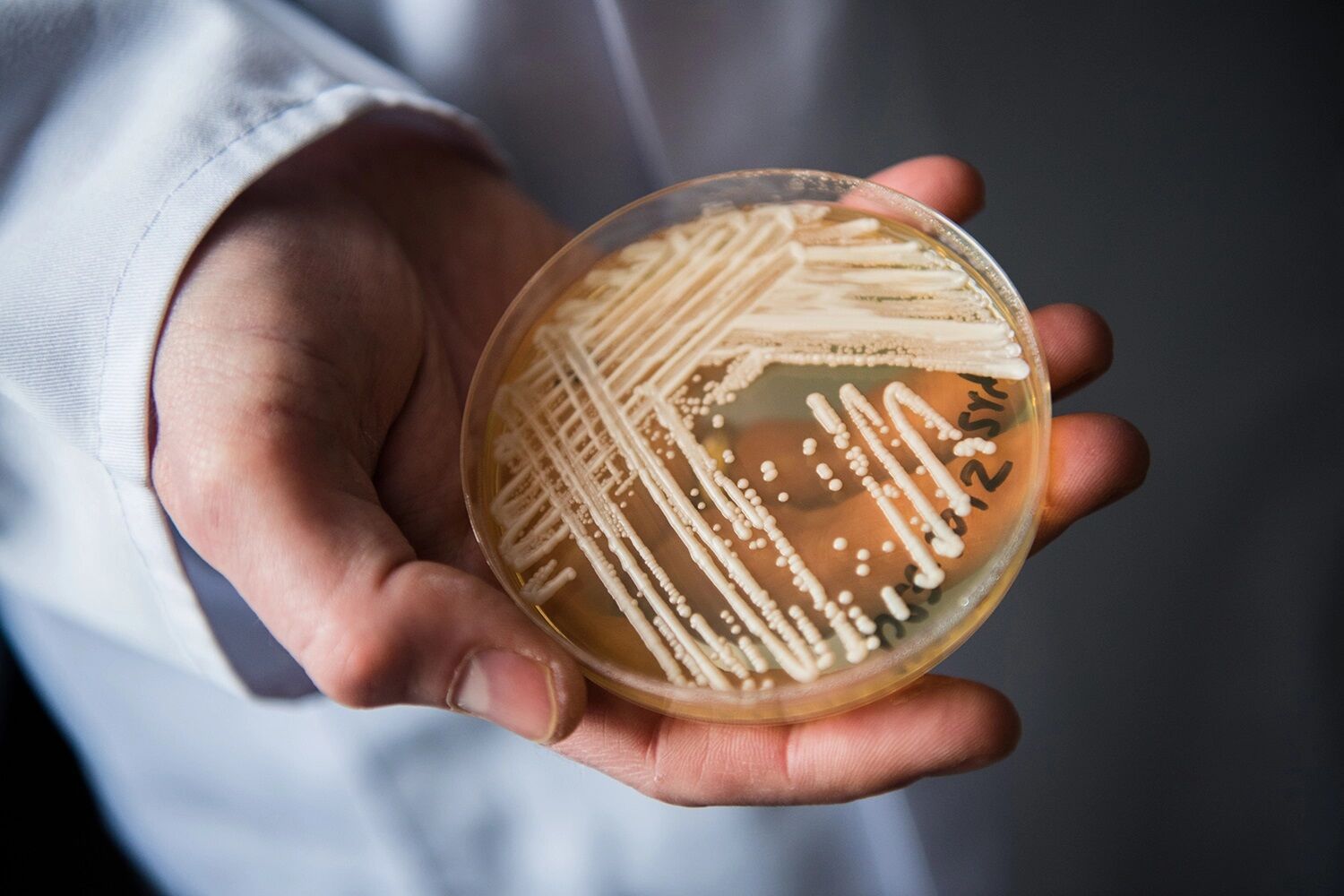 Candida auris: entenda o que é o superfungo que causa preocupação global Candida auris: entenda o que é o superfungo que causa preocupação global