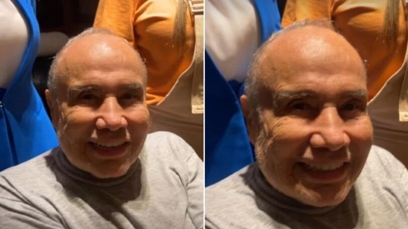 Stênio Garcia afirma que rosto está normal após harmonização facial