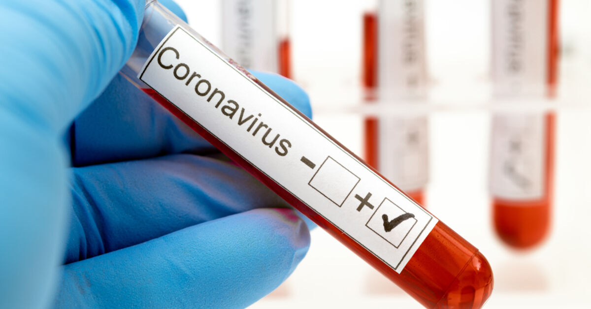 Paraíba confirma 547 novos casos de Covid-19 em 24h; total de mortos chega a 1.850 e 84.008 infectados Paraíba confirma 547 novos casos de Covid-19 em 24h; total de mortos chega a 1.850 e 84.008 infectados