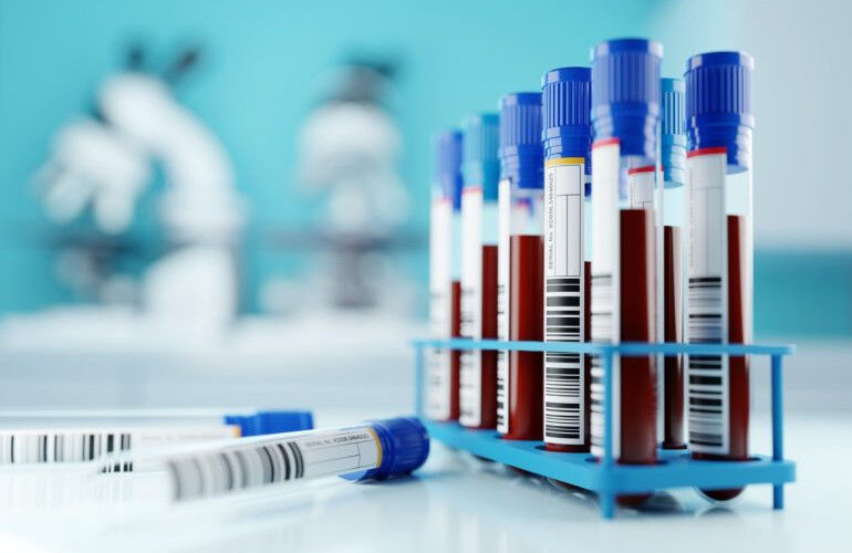 Com 4 mil habitantes, São josé do Sabugi abre licitação de R$ 606 mil para realização de exames laboratoriais