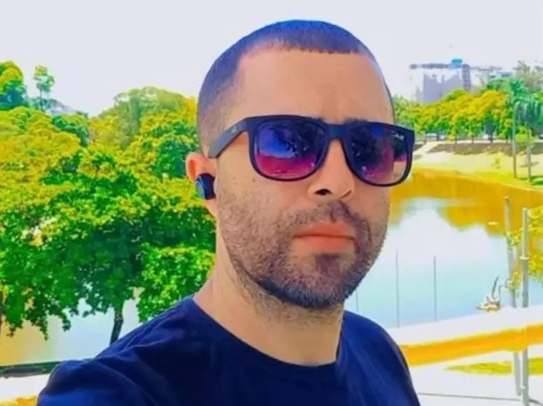 Motorista que atropelou Kayky Brito vira influenciador e faz harmonização facial